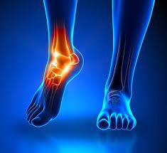 Ankle Pain Treatment